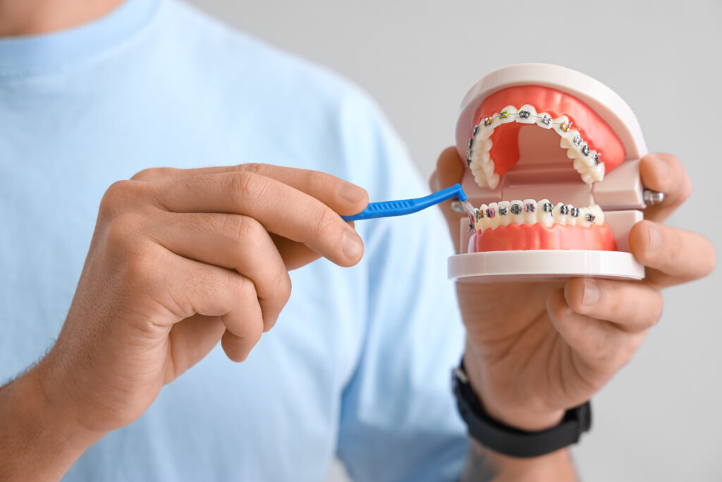 矯正中の歯磨きの仕方を見せるイメージ
